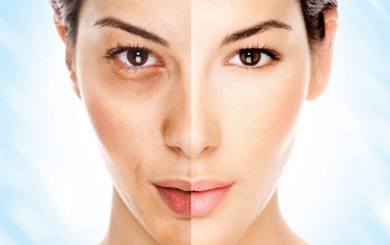 Skin Whitening Home Remedies