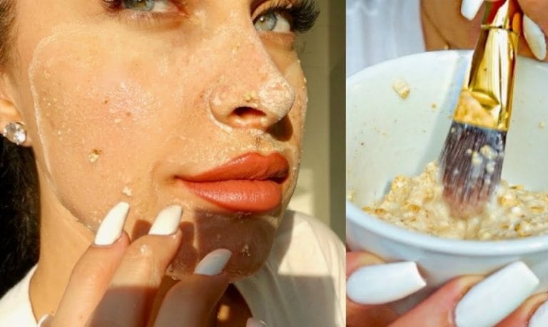 Three Main Recipes Homemade Acne Mask
